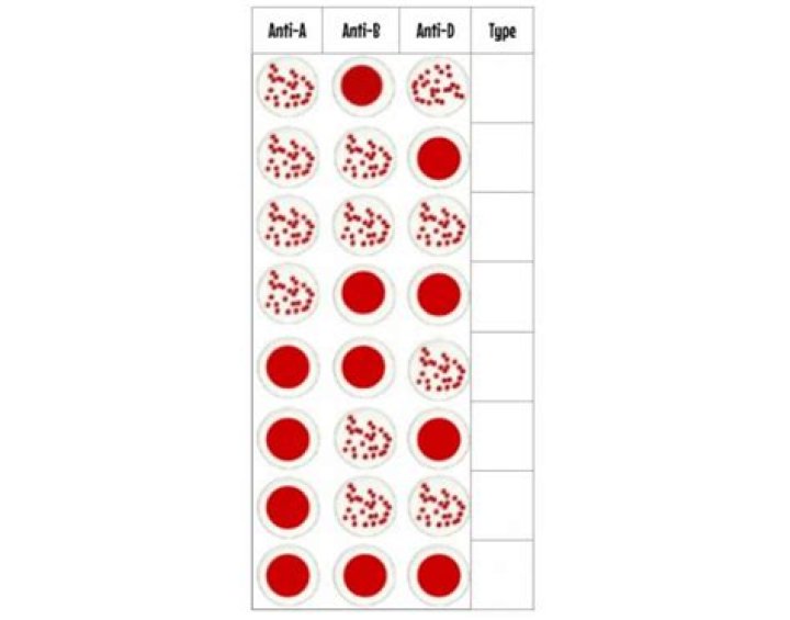 Blood Typing Card Results Quiz