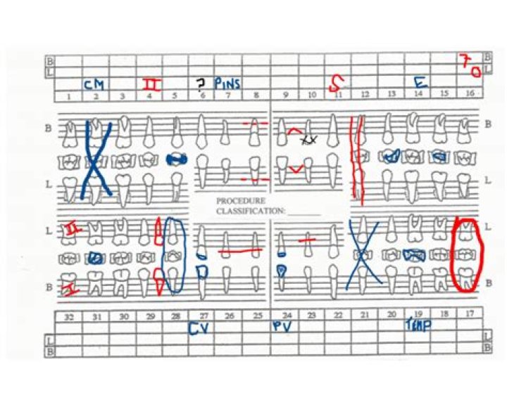 Dental Charting Quiz