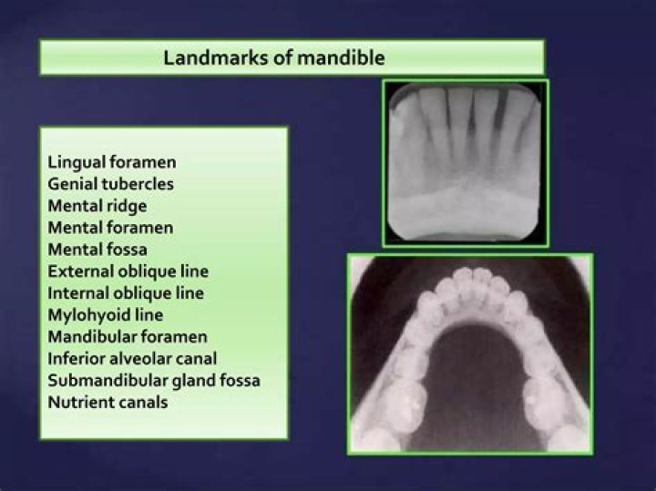Dental Radiology — Landmarks of the Mandible Quiz