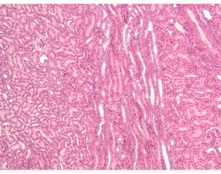 Histology of Renal Medulla Quiz