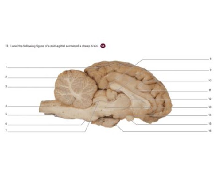 midsagittal view sheep brain Quiz
