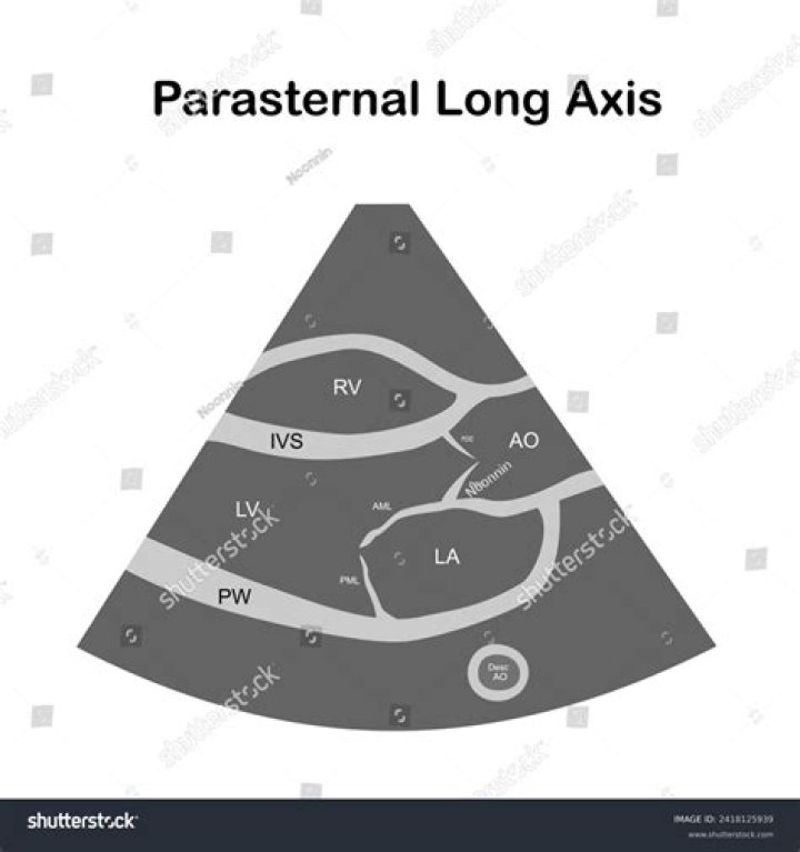 Parasternal Long Axis View Quiz