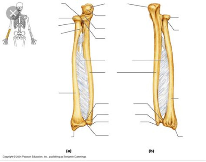 Radius and Ulna labeling Quiz
